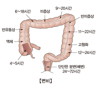 변비