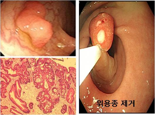 위용종