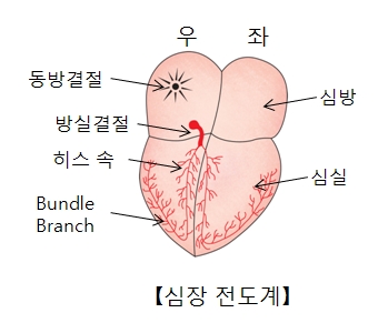 심실세동