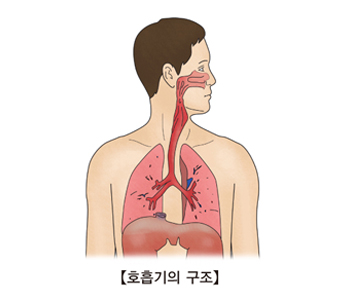 비소세포성 폐암