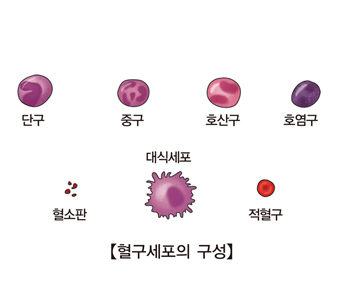 철 결핍성 빈혈