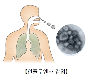 파라인플루엔자 감염증