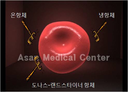 자가면역성 용혈성 질환