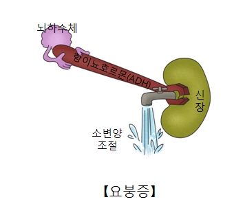 요붕증