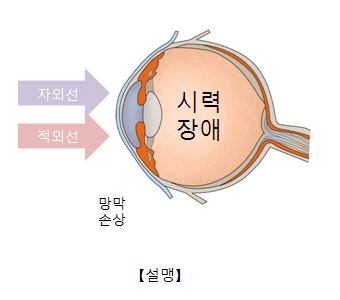 설맹