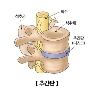 추간판