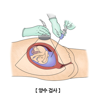 양수검사