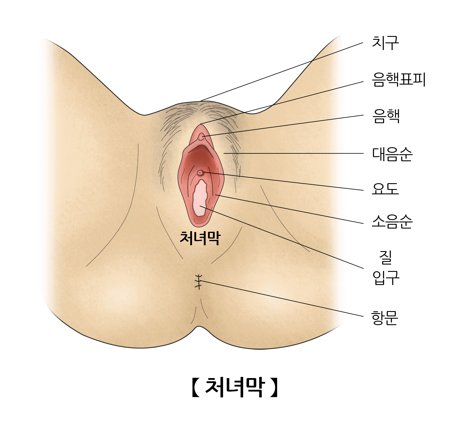 처녀막